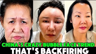 Asia’s “Bubble Face” Disaster: When Beauty Treatments Go Too Far