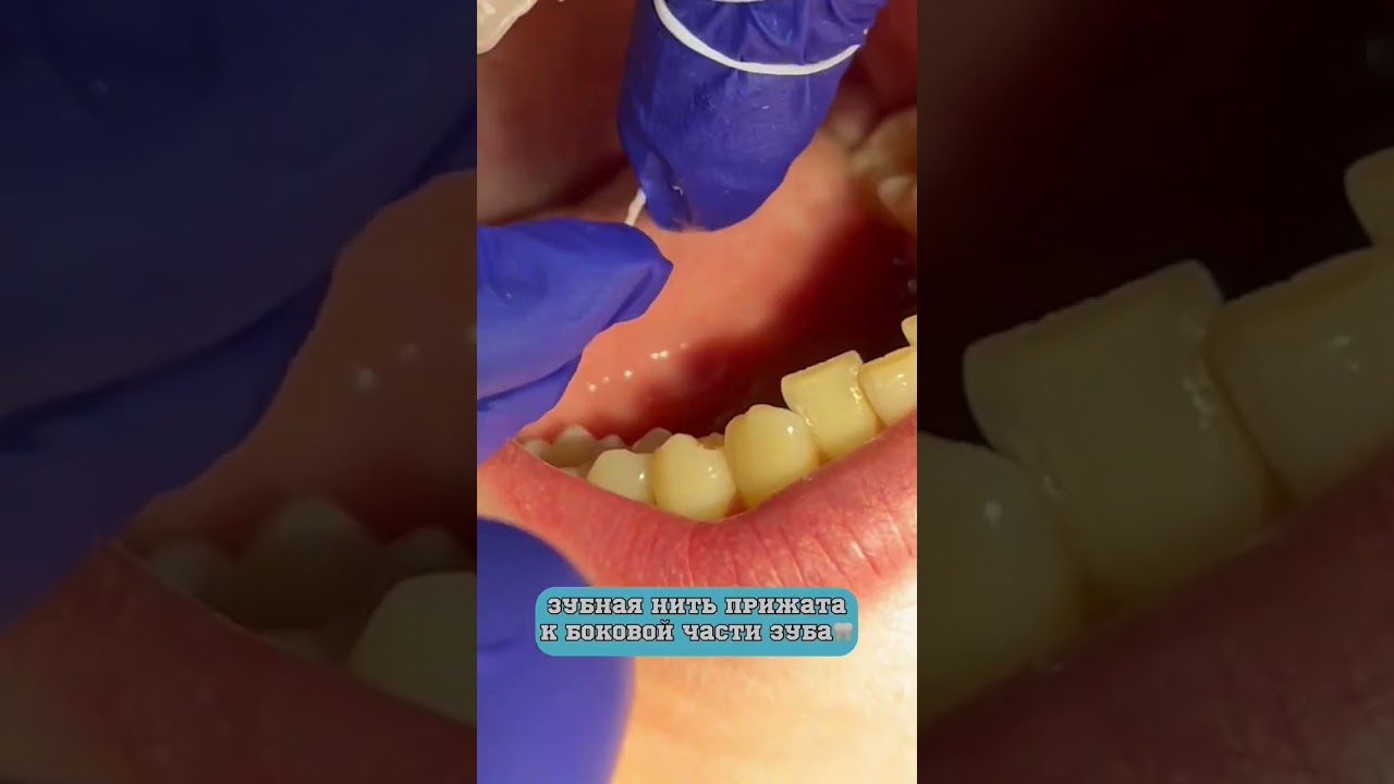 КАК ПОЛЬЗОВАТЬСЯ ЗУБНОЙ НИТЬЮ? 🧵