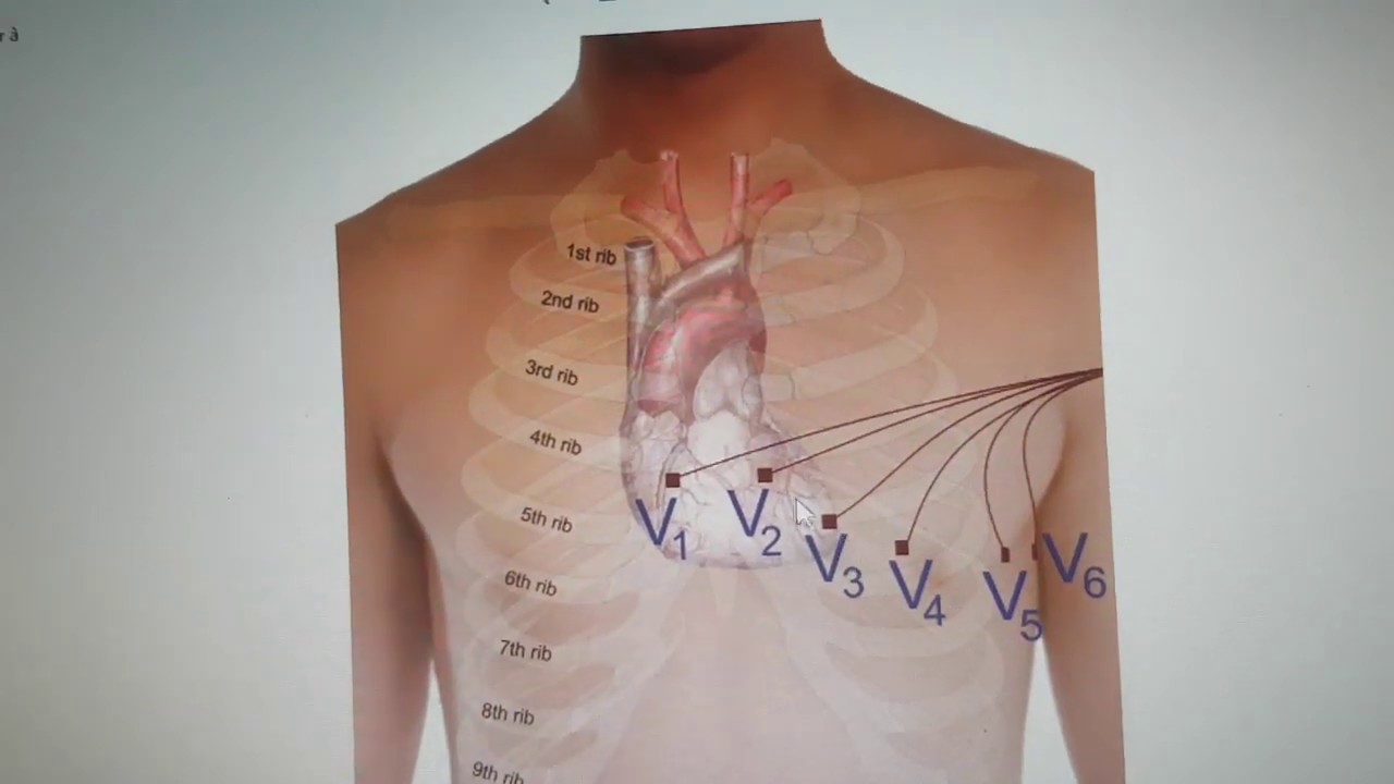 formation ECG 7/des différent derivation de ECG YouTube