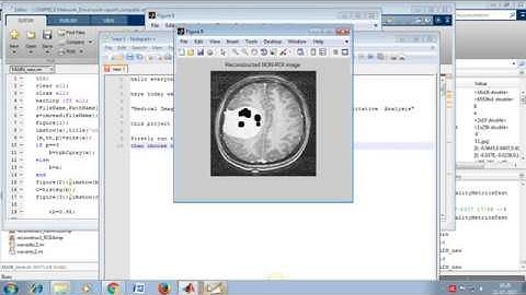 Medical Image Fusion Based on  DWT and SPIHT Techniques with Quantitative  Analysis