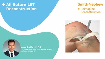 All-Suture Modified Lemaire Extra-Articular Tenodesis (LET)