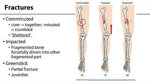 MSK Skeletal System Basics - Fractures