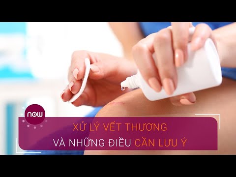 Video: Cách điều Trị Vết Thương Cho Trẻ