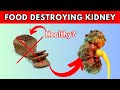 You Cannot Heal Your Kidneys If You Still Eat These 22 Foods