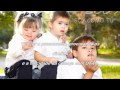 Síndrome de Down - HD