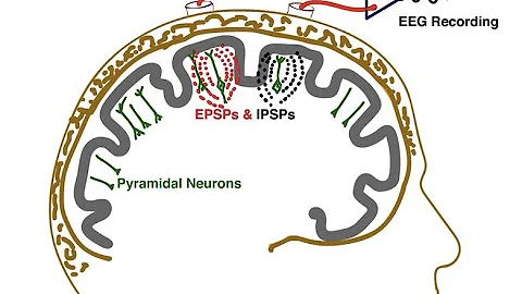 The Essential EEG Concepts you MUST master