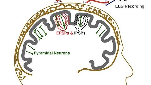 The Essential EEG Concepts you MUST master