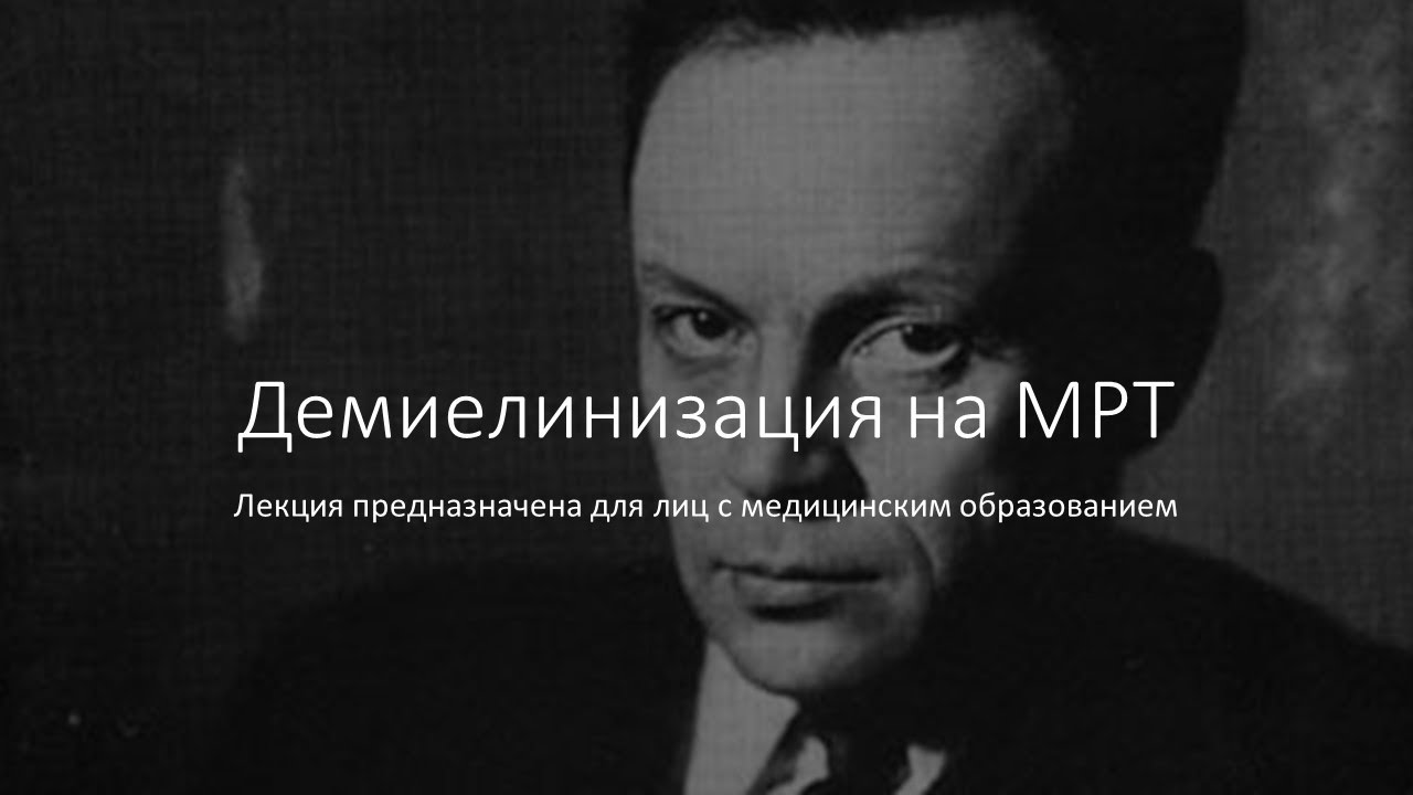Демиелинизация на МРТ