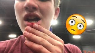 I BUSTED MY LIP!!!!!!!