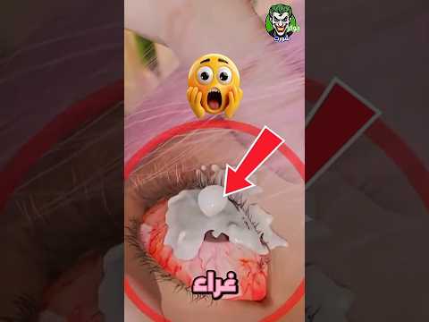 إي اك أن تفعل هذا إذا دخل الغراء في عينك 