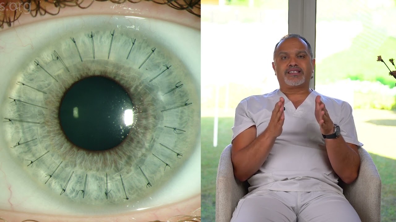 الرؤية بعد عملية ترقيع القرنية