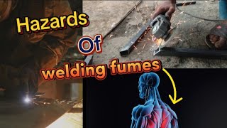 Welding fumes can be a serious Health Issue