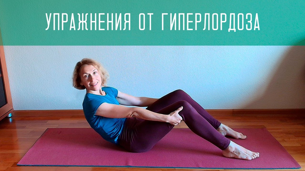 Упражнения от гиперлордоза и боли в пояснице