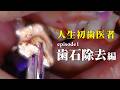【歯石除去初体験】人生初歯医者‼️　episode1 　歯石除去編