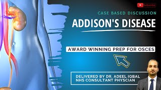 Addison's Disease - Endocrinology - BEST OSCE Preparation for Medical Student Exams