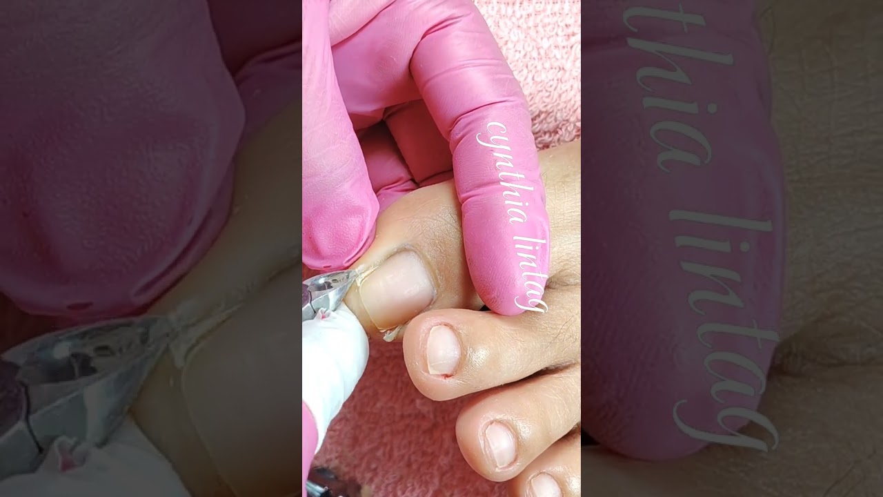 Full video pedicure and dryskin removal