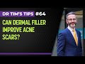 Can dermal filler improve acne scars?