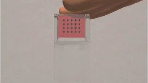 Lab-on-a-Chip Enables Personalized Medicine
