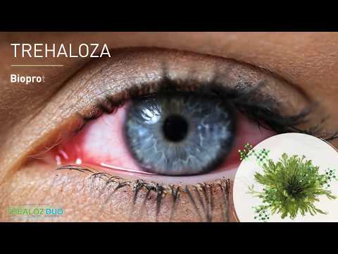Video: Kronični Simptomi In Znaki Suhega Očesa