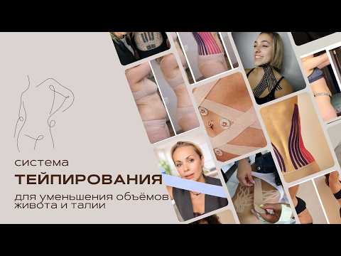 Интенсив по тейпированию живота и талии