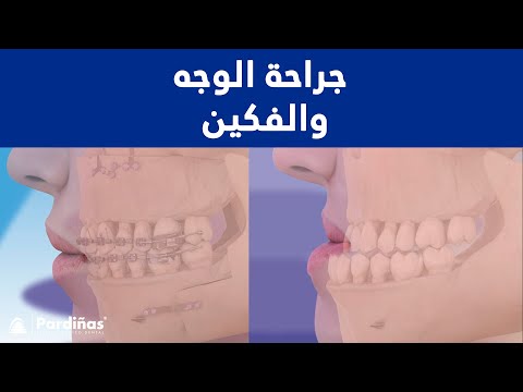 جراحة الوجه والفكين