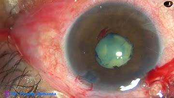 Iris hooks and B-HEX : Tips and Tricks... Pradip Mohanta, 12th July, 2019