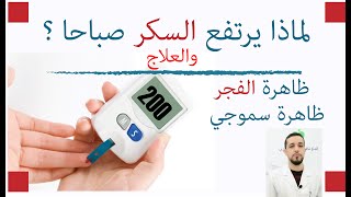 علاج ارتفاع السكر في الصباح-لماذا يرتفع السكر صباحا