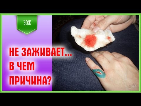 В чем причина долго не заживающих ран?