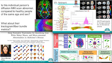 Global Neuroimaging Studies with Diffusion MRI, Tractometry, and Generative AI