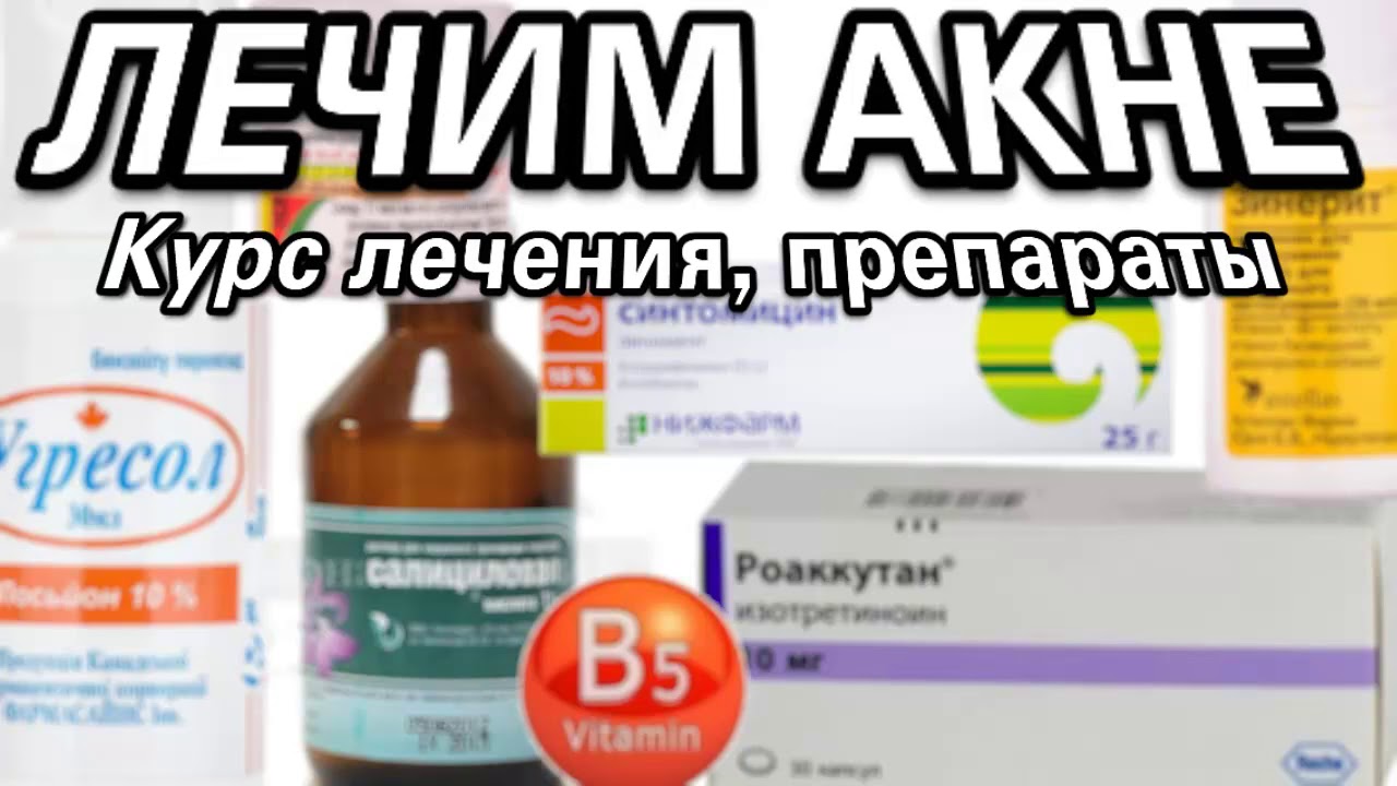 Лечение прыщей (акне, угри). Препараты и курс лечения. Как избавиться ...