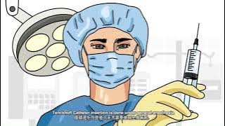 Tenckhoff Catheter Insertion