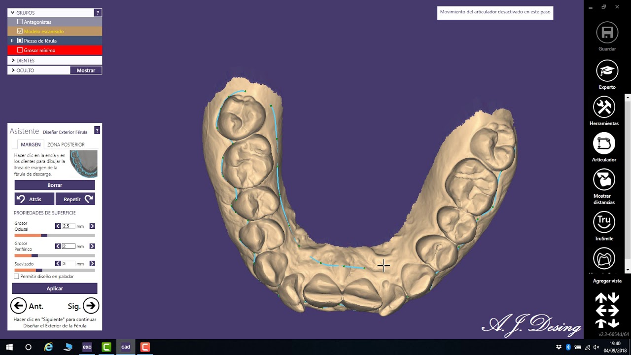 Exocad - 001 Ferula de descarga