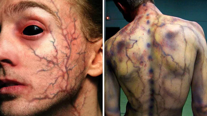 8 People Who Gained REAL SUPERPOWERS After An Accident!