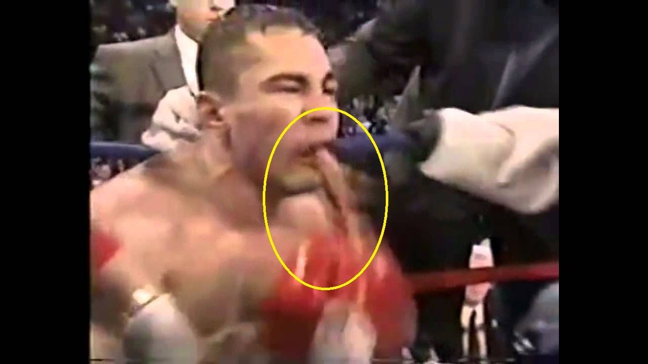 Boxer Vomits blood.Hurt Badly - YouTube