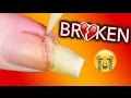 MY LIFE IS OVER I AM BROKEN / Fixing my broken nail