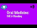 Oral Medicine | INR & Bleeding | INBDE