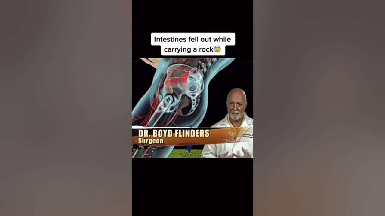 Worst ways people have died 16 YouTube