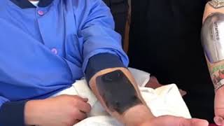 Jake Paul Vlog camera in his Hand Surgery
