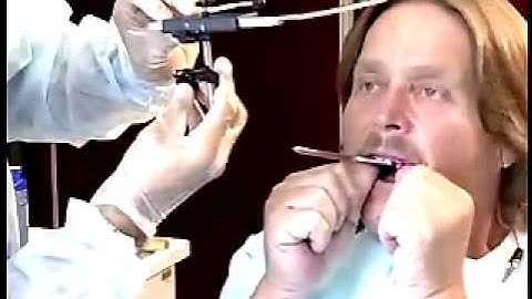 16 www.4dent.net - Face-Bow Centric Relation Recording