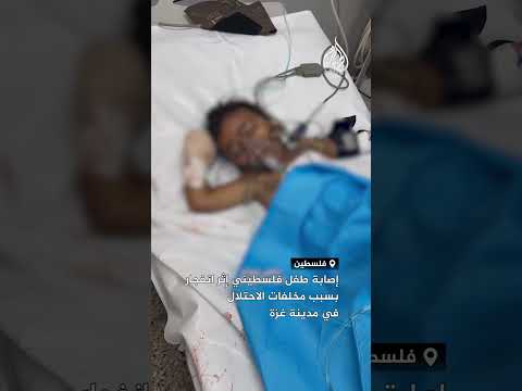 إصابة طفل فلسطيني إثر انفجار بسبب مخلفات الاحتلال في مدينة غزة