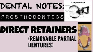 DENTAL NOTES II STUDY WITH ME II REMOVABLE PARTIAL DENTURES II DIRECT RETAINERS II PROSTHODONTICS