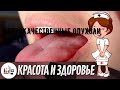 Доброкачественные опухоли языка