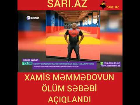 XAMİS MƏMMƏDOVUN ÖLÜM SƏBƏBİ AÇIQLANDI-SARI.AZ