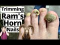 Trimming EXTREMELY Thick Ram's Horn Fungal Toenails!! *NOT CLICK-BAIT*