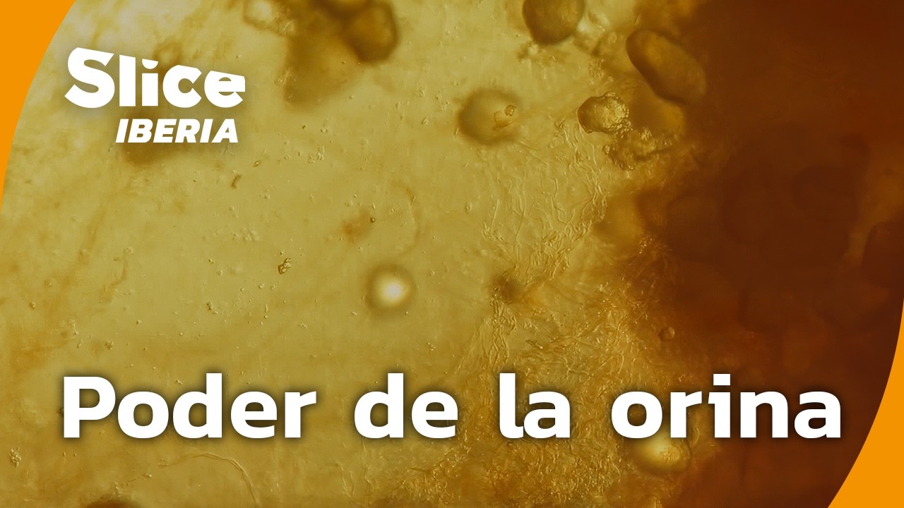 El Sorprendente Valor Oculto de la Orina | SLICE Iberia | DOCUMENTAL COMPLETO