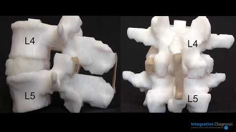 Biomechanics of the Lumbar Spine: Lumbar Capsule and Supraspinous