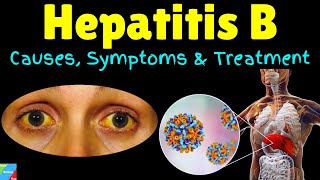 Hepatitis B - Symptoms, Causes, Risk Factors, Pathophysiology, Diagnosis, Treatment