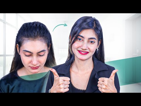 Female Hair Transplant Result: Natural Hairline 😲 | New Roots | Bangladesh
