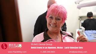 Dental Crowns in Los Algodones, Mexico by RUMO Dental Group - Laurie Valenciano Story