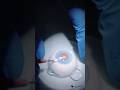 Practicing Eye Surgery Make You Perfect Ophthalmology Drylab Microsurgery 
